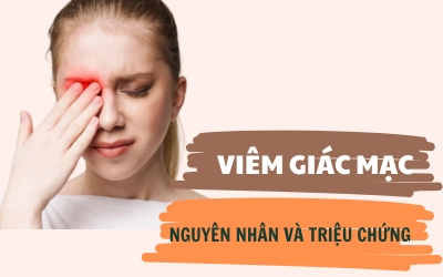 Viêm giác mạc - Nguyên nhân và triệu chứng